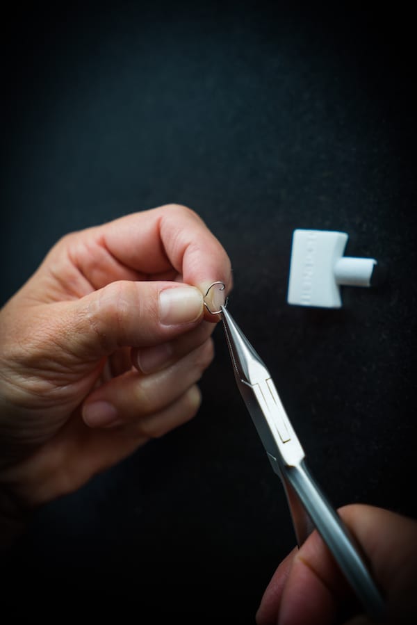 Angelegte Nagelkorrekturspange an einem Zehennagel